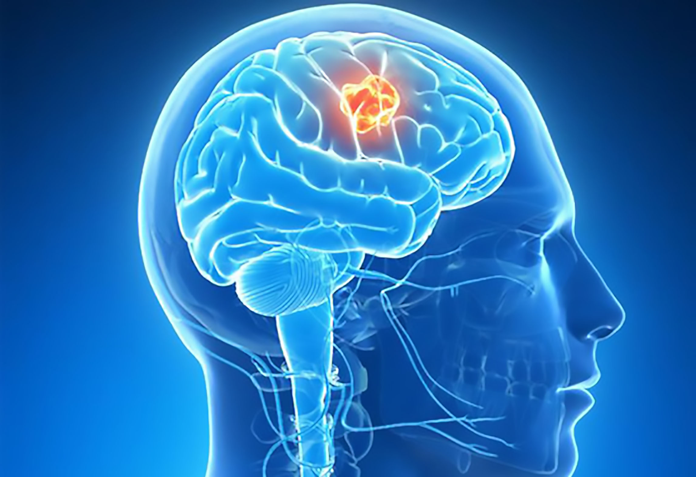Relaunch 4NeuroSurgery